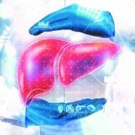 Cholesterol HDL