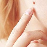 Dermatolog