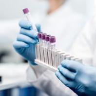 Ocena predyspozycji do endometriozy - test EndomKIT