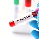 Anti-SARS-CoV-2 IgG virus antibodies quantified