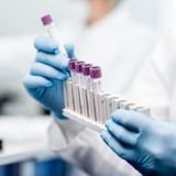 Endometriosis predisposition assessment - EndomKIT test