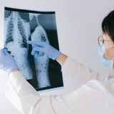 Spine X-ray AP View (Scoliosis)