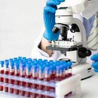 Serologia kiły (VDRL)