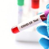 SARS-CoV-2 total antibodies quantitative (against RBD domain)