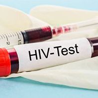 Test na HIV Ag/Ab (Combo)