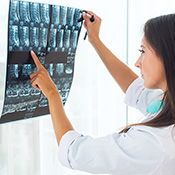 RTG obu stawów kolanowych w pozycji stojącej - dorośli