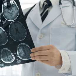 Neurolog
