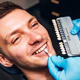 Wybielanie zębów - 2 łuki