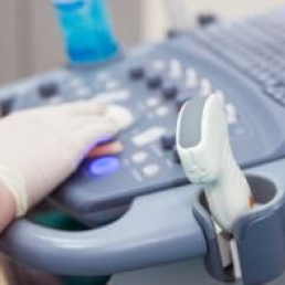 Cardiac echocardiogram with Doppler – adults